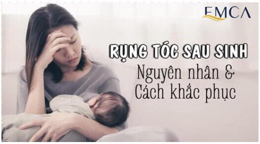 Rụng tóc sau sinh – Vấn đề thường gặp nhưng không thể xem nhẹ